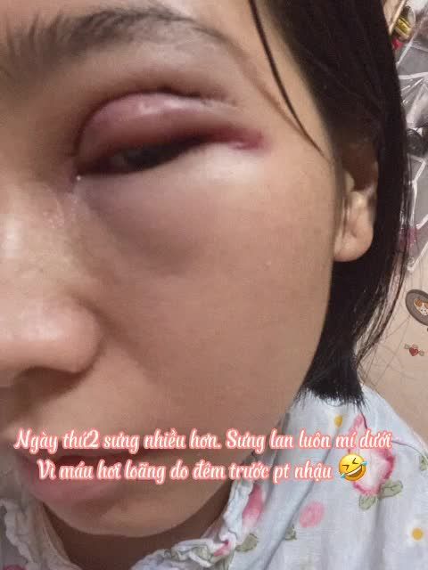 MUỐN ĐẸP…ĐỪNG QUÁ NÔN NÓNG NHÉ KHÁCH ƠI!